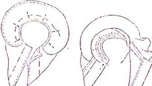 Відкладним коміром до виробів із застібкою пришивають, як показано на кресленні разом з подбортов, комір при цьому вставляється між горловиною і подбортов і застрочують відразу суцільний рядком